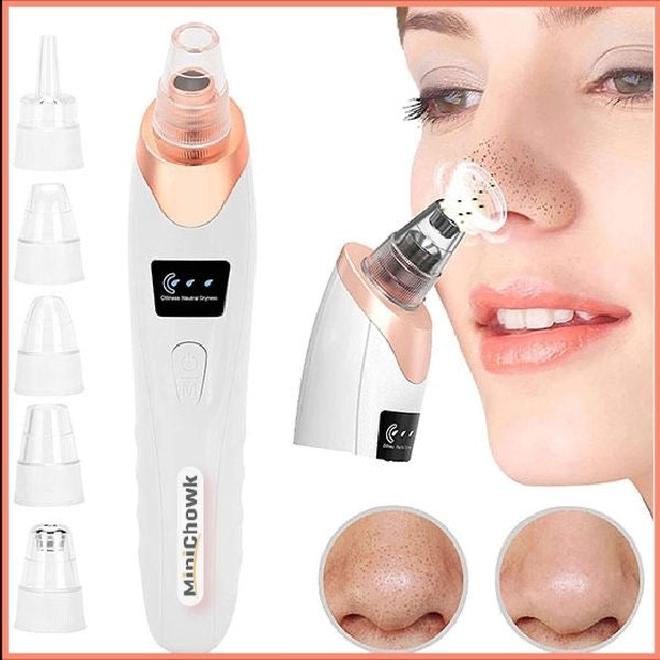 5-in-1 Electric Blackhead Remover Vacuum